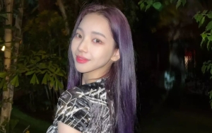 Karina aespa Tunjukkan Wajah Bengkaknya Usai Cabut Gigi, Tetap Cantik?
