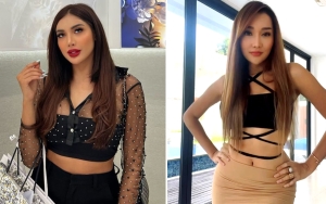 Paras Millendaru Kini Disebut Pangling Hingga Dikira Kylie Jenner, Dibandingkan dengan Lucinta Luna