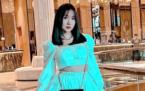 Inilah Wajah Baru Lucinta Luna Pasca Oplas, Malah Disebut Lebih Cantik Dulu?