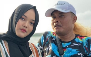 Sule Edit Fotonya Jadi Perempuan, Disebut Plek Ketiplek Mirip Putri Delina
