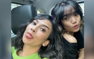 Wajah Disebut Berubah, Fuji Adik Ipar Vanessa Angel Ngode Filler Hidung Harga Selangit?