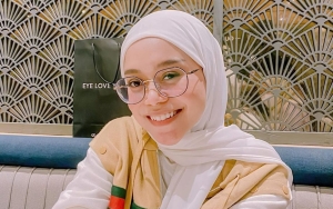 Kabar Mata Lesti Kejora Sempat Lebam Heboh Lagi, Ternyata Ini Alasannya