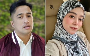  Dibocorkan Irfan Hakim, Lesti Kejora Ngaku Sakit Tipes Sebelum Kabar Laporkan KDRT Mencuat