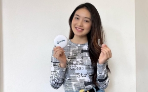 Natasha Wilona Akui Takut dan Deg-degan Saat ke Dokter Gigi