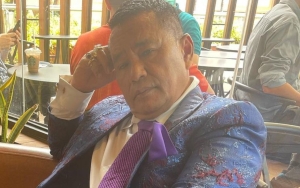 Hotman Paris Sindir Rumah Tangga Hotma Sitompul Usai Ingin Rizky Billar-Lesti Kejora Berdamai
