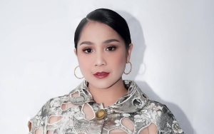 Bukannya Sakit, Nagita Slavina Santai Saat Perdana Dikerokin Hingga Merah