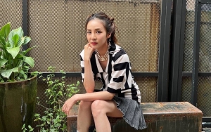 Sandara Park Eks 2NE1 Sambat Efek Samping Usai Jalani Operasi Bibir