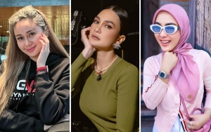 Denise Chariesta Beber Sikap Beda Reino Barack ke Luna Maya-Syahrini