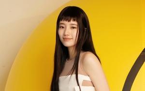 Suzy Pose Imut Bak Remaja, Visual Awet Muda Tuai Decak Kagum