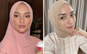 Citra Kirana Dikira Oplas, Intip 10 Potretnya Glowing Tanpa Make Up
