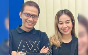 Doddy Sudrajat Sebut Hidung Mayang Sudah Mulai Berubah Usai Jalani Operasi