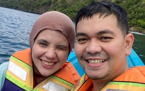 Biaya Indra Bekti di ICU Nyaris Miliaran, Aldila Jelita: Terlalu Riskan untuk Dipindah