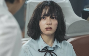 Dada Besar Jung Ji So Diyakini Jadi Alasan Utama Bullying 'The Glory'