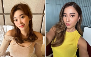 Livy Renata Bikin Pangling di Pemotretan Nuansa Imlek, Disebut Mirip Nikita Willy