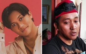 Bukan Rizky Febian, Sosok yang Rawat Bintang Usai Teddy Pardiyana Dipenjara Terungkap