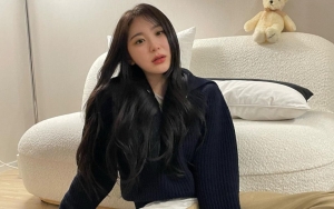 Lee Chaeyeon Eks IZ*ONE Dituding Oplas Hidung, Instagram Banjir Komentar Julid