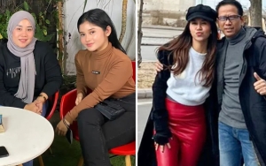 Wajah Chika Eks Adik Tiri Vanessa Angel Cantik Tanpa Oplas Mirip Fuji An, Mayang Kena Sentil 
