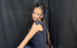 Jennie BLACKPINK Alami Insiden Hingga Wajah Terluka, Gercep Minta Fans Agar Tak Panik