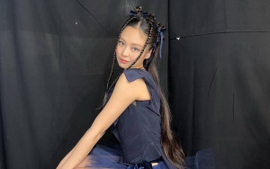 Tak Lagi Malu, Jennie PeDe Pamer Cedera di Bawah Matanya Saat Betolak Ke Paris