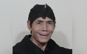 Divonis Kanker Paru, Kondisi Untung Blangkon Sempat Membaik Sebelum Meninggal Dunia
