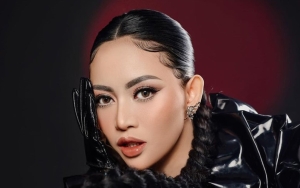 Masih Bengkak, Rachel Vennya PD Pamer Wajah Tirus Usai Lakukan Pengambilan Lemak di Pipi
