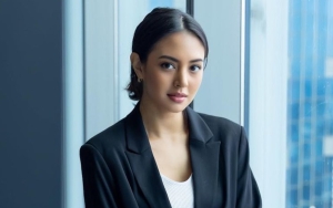 Aurelie Moeremans Divonis Tumor Colli, Rahang Alami Kelumpuhan Usai Disuntik