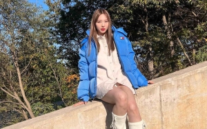 Nayeon TWICE Tunjukkan Gigi Baru di Pemotretan, Kini Tampil Lebih Elegan