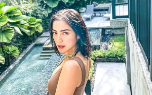 Jessica Iskandar Oplas Hidung di Korea, Pengakuan Sempat Bangkrut Langsung Diungkit