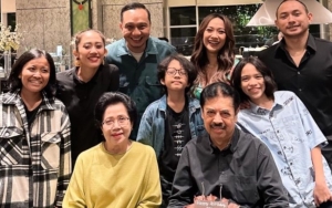 BCL Pamer Kondisi Kulit Merah-Merah Usai Diduga Liburan ke Bali Bareng Tiko Pacar Baru
