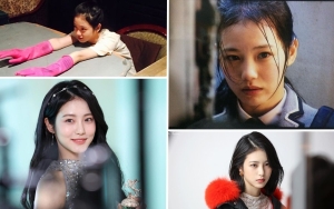 Foto Lawas Shin Ye Eun 'The Glory' Bikin Pangling, Intip 10 Potretnya Dari Masa ke Masa