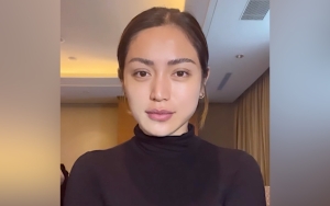 Jessica Iskandar Berasa Mirip Unnie Korea Saat Pandangi Wajah Sehabis Oplas