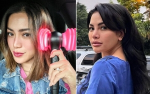 Jessica Iskandar Dibilang Mirip Nikita Mirzani Gara-Gara Hasil Oplas Hidung