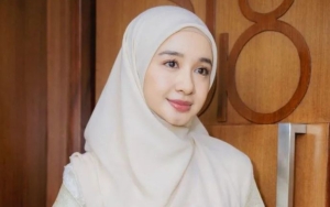 Laudya Cynthia Bella Pamer Wajah Keriput, Kecantikan Alami Tetap Terpancar