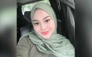 Aurel Hermansyah Kisahkan Rahasia Glow Up Saat SMA Sampai Pernah Dikira Oplas