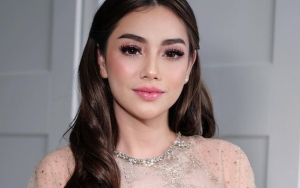 Celine Evangelista Tetap Cantik Dalam Balutan Baju Ngejreng, Kaki Mulus Bikin Salfok