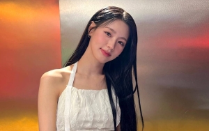 Miyeon (G)I-DLE Tetap Rasakan Susah Meski Punya Wajah Cantik