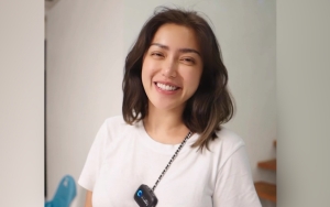 Jessica Iskandar Tuai Pro-Kontra Usai Berterima Kasih Pada Tuhan Atas Hidung Barunya