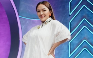 Bantah Oplas, Siti Badriah Justru Salfok Lihat Wajahnya Terlalu Glowing
