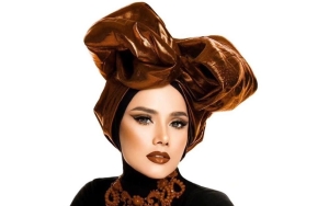 Paras Mulan Jameela Disebut Sedikit Beda Dari Biasa Usai Lakukan Perawatan Hollywood Smile
