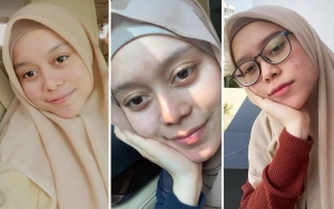 Dipuji Denny Sumargo, Intip 7 Potret Lesti Kejora Natural No Make Up
