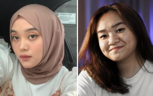 Putri Delina Syok Usai Threads Disentil Adik Nathalie Holscher, Alasan Posting Diluar Dugaan