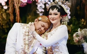 Dituding Oplas, Visual Bella Bonita Istri Denny Caknan Before-After Glow Up Curi Atensi