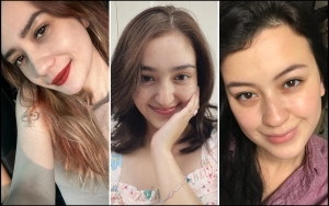 Punya Putri Anne Alami, Intip 9 Potret Artis Indonesia Pamer Wajah dengan Freckles