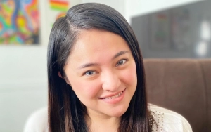 Marshanda Dijauhi Artis Papan Atas Gegara Derita Bipolar, Adab Tak Umbar Identitas Berkelas
