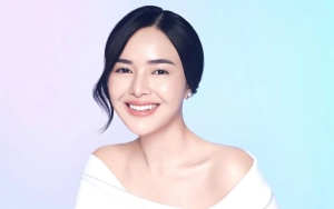 Amanda Manopo Dikasari Fans Hingga Luka-luka, Balasannya Tak Terduga