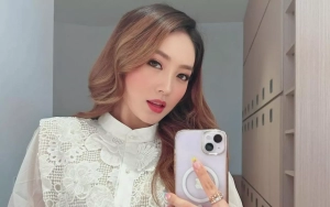 Bentuk Hidung Natasha Wilona Dinilai Beda Hingga Dugaan Oplas Mencuat