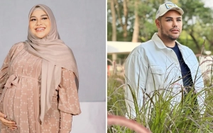 Aurel Hermansyah Beri Jawaban Tak Biasa Ketika Disentil Mirip Ivan Gunawan
