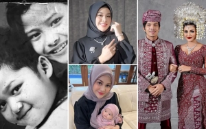 10 Transformasi Aurel Hermansyah yang Kini Berstatus Ibu Dua Anak