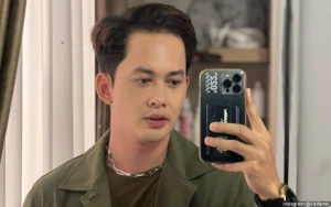 Kiki Farrel Emosi Dituduh Permak Wajah Imbas Foto dengan Pipi Memerah
