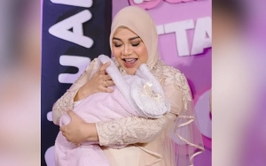 Aurel Hermansyah Jadikan Baby Azura Sebagai Bukti Tak Lakukan Filler Bibir